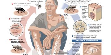 World NTDs Day: Gombe faces high risks of Biharzia, River Blindness, Elephantiasis, say experts