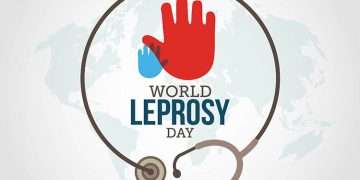 World Leprosy Day: Expert suggests immunisation to prevent disease