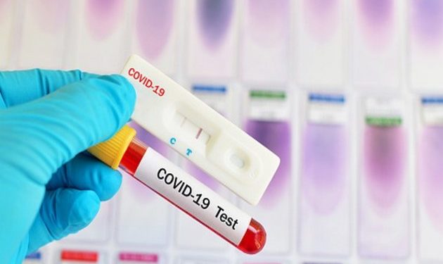 Study finds 96 pc of COVID-19 patients have antibodies