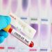 Over 13,000 coronavirus variants detected in Russia