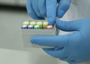 Labs in Belgium unable to cope with surging demand for COVID-19 tests