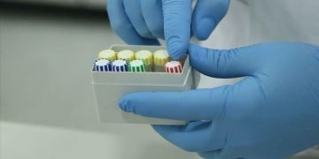 Labs in Belgium unable to cope with surging demand for COVID-19 tests
