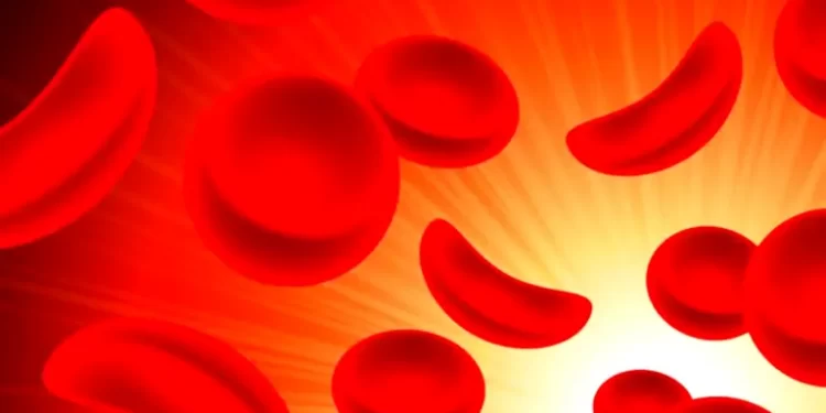 Tackling sickle cell and hepatitis in Nigeria