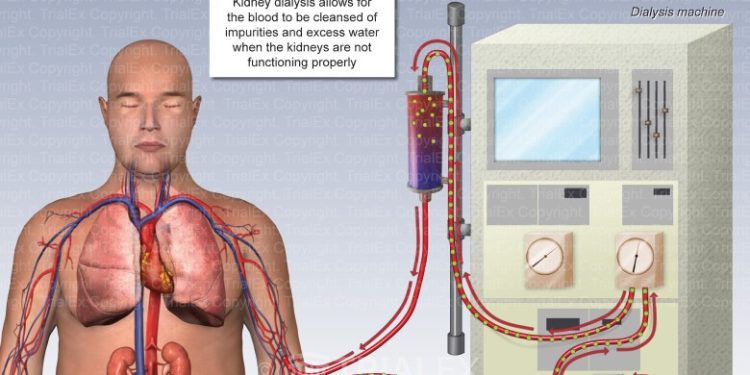 Senate wants NHIS coverage as 25 million Nigerians battle kidney disease