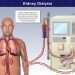 Senate wants NHIS coverage as 25 million Nigerians battle kidney disease