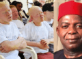 Abia albinos seeks Governor Otti’s support