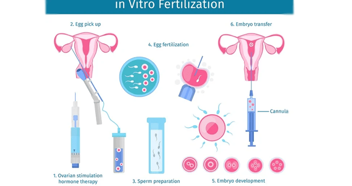 Fertility specialist calls for inclusion of IVF in health insurance plans