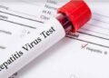 Hepatitis: Nasarawa to screen 2.4 million residents by 2030