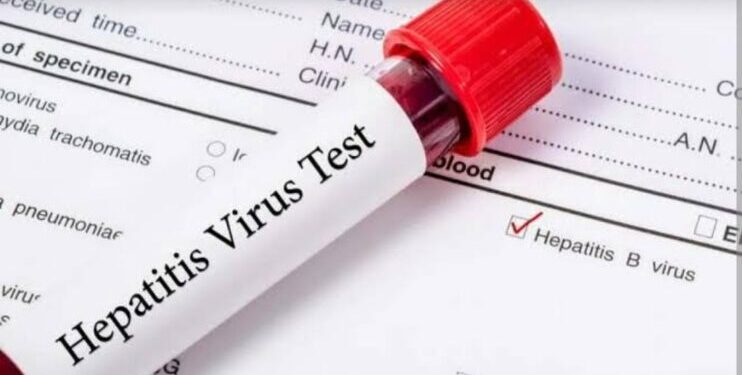 Hepatitis: Nasarawa to screen 2.4 million residents by 2030