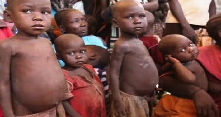 Four million children in North-East, North-West malnourished: FG