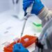 Kenya confirms its 1st mpox case as virus spreads in Africa