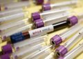 African countries, partners pledge $800M for Africa’s mpox response