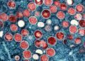 Zambia records first mpox case: Health minister
