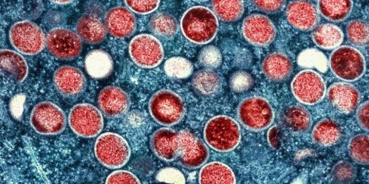 Zambia records first mpox case: Health minister