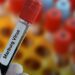 Rwanda announces end of Marburg virus disease outbreak
