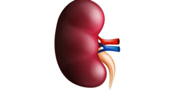 Yobe, centre partner to tackle kidney disease