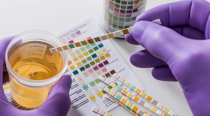 Eight Kwara teachers shortlisted for TESCOM job fail drug test