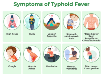 Experts recommend urgent action against typhoid outbreaks