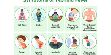 Experts recommend urgent action against typhoid outbreaks