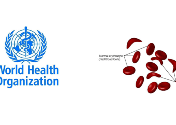 WHO issues guideline on pregnancy care for women with sickle cell disease