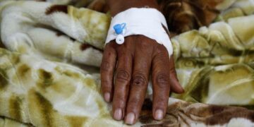 Africa unveils continental cholera emergency preparedness, response plan