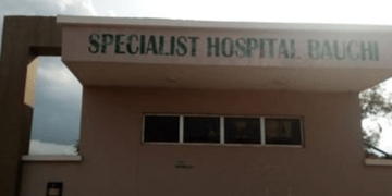 Bauchi procures 13 tuberculosis X-ray machines worth $1.9 million