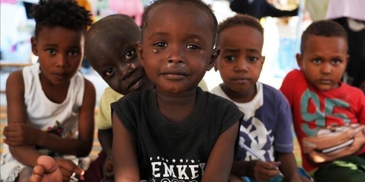 3 children die every day in Sudan’s El-Fasher amid worsening malnutrition: Medics