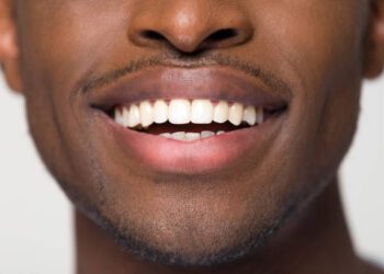 Dental association warns Nigerians against careless oral habits