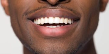 Dental association warns Nigerians against careless oral habits
