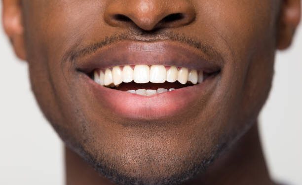 Dental association warns Nigerians against careless oral habits