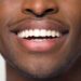 Dental association warns Nigerians against careless oral habits