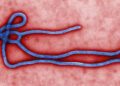 EXPLAINER – What to know as Ebola outbreak raises global alarm