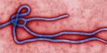 EXPLAINER – What to know as Ebola outbreak raises global alarm