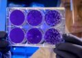 Samples from Italian man with suspected hantavirus sent to hospital: Report