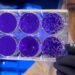 Samples from Italian man with suspected hantavirus sent to hospital: Report