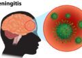 Meningitis killed 34 residents in nine Sokoto LGAs: Official