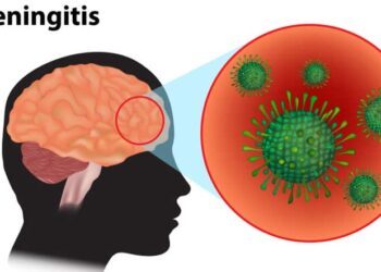 Meningitis killed 34 residents in nine Sokoto LGAs: Official