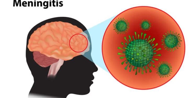 Meningitis killed 34 residents in nine Sokoto LGAs: Official