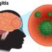 Meningitis killed 34 residents in nine Sokoto LGAs: Official