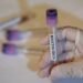 WHO announces hantavirus outbreak over