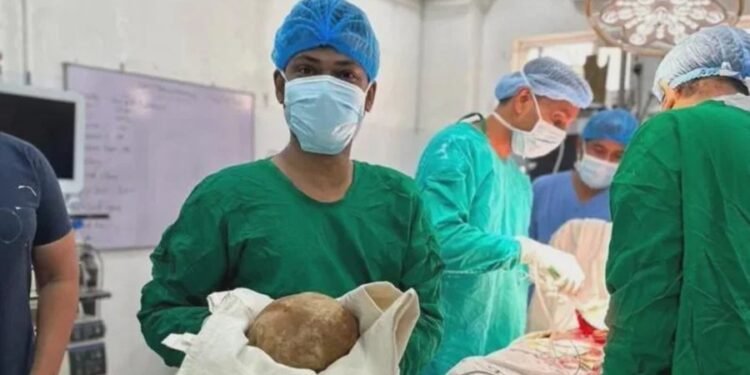 Doctors remove 3.1kg bladder stone from man in Sri Lanka