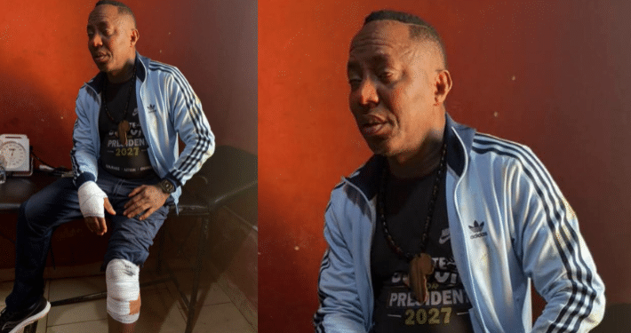 Sowore sustains injuries as police rescue him from suspected thugs at Ekiti restaurant